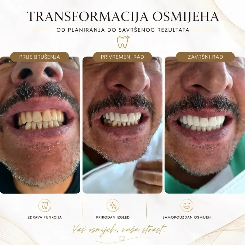 Objava ordinacije Arsenović: transformacija osmijeha u tri koraka